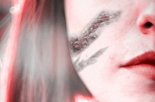 Perché e come le cicatrici si formano, prudono e fanno male con il clima?