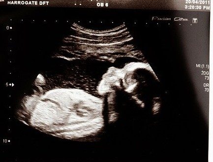 come-respira-il-feto-nel-grembo-materno