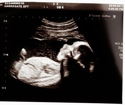 come-respira-il-feto-nel-grembo-materno